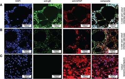 Differential Impacts of HHV-6A versus HHV-6B Infection in Differentiated Human Neural Stem Cells